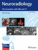 Neuroradiology -  Val M. Runge