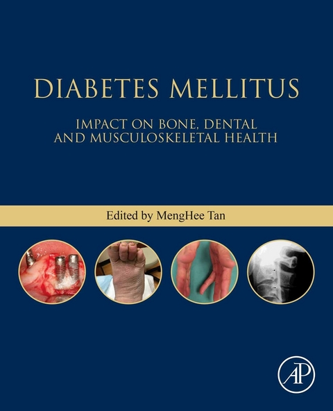 Diabetes Mellitus - 