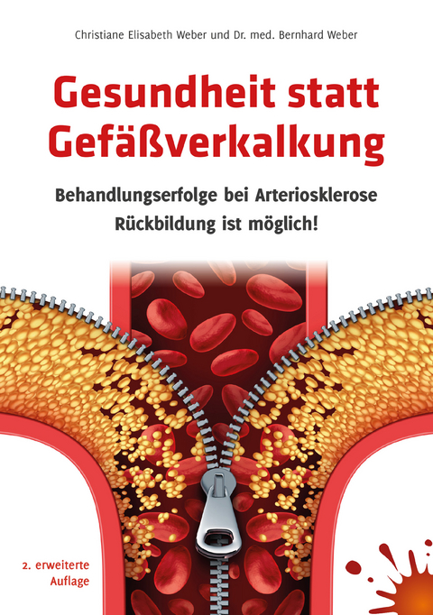 Gesundheit statt Gefäßverkalkung -  Christiane Elisabeth Weber,  Dr. med. Bernhard Weber