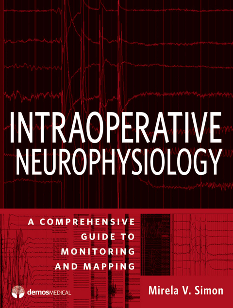 Intraoperative Neurophysiology - 