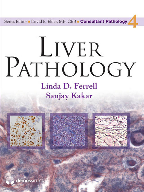 Liver Pathology - 