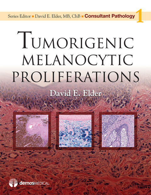 Tumorigenic Melanocytic Proliferations - David Elder