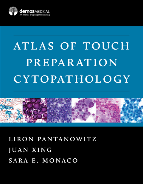 Atlas of Touch Preparation Cytopathology - Sara E. Monaco, Liron Pantanowitz, Juan Xing