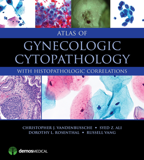 Atlas of Gynecologic Cytopathology - Christopher J. VandenBussche, Syed Z. Ali, Dorothy L. Rosenthal, Russell Vang