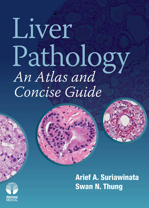 Liver Pathology - Arief Suriawinata, Swan N. Thung