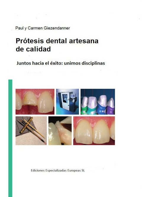 Prótesis dental artesanal de calidad - Paul Giezendanner, Carmen Giezendanner