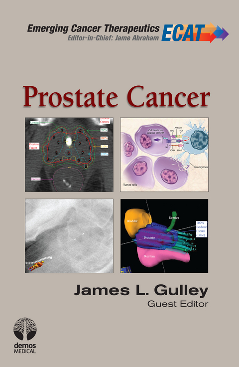 Prostate Cancer