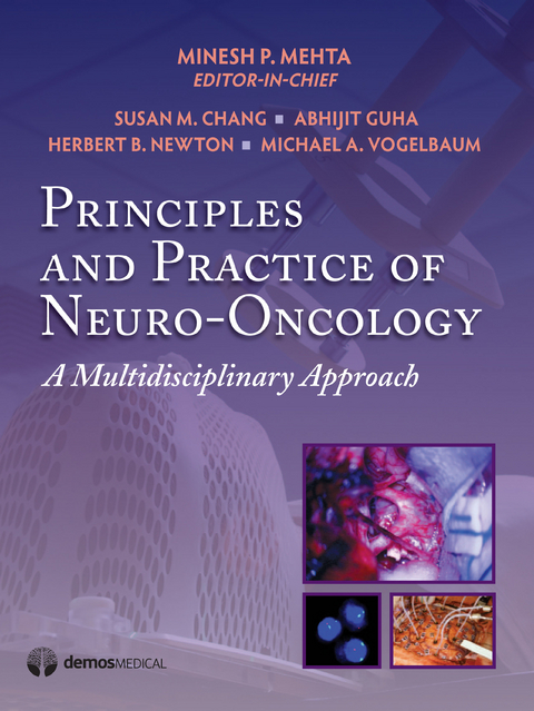 Principles & Practice of Neuro-Oncology