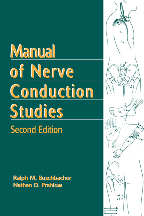 Manual of Nerve Conduction Studies, Second Edition -  MD Nathan D. Prahlow,  MD Ralph Buschbacher