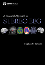 Practical Approach to Stereo EEG - 