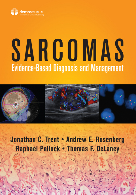 Sarcomas - 