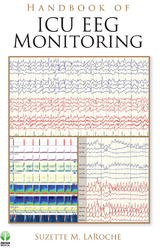 Handbook of ICU EEG Monitoring - 