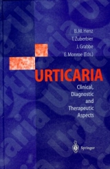 Urticaria - 