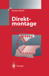 Direktmontage - 