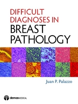 Difficult Diagnoses in Breast Pathology - Juan P. Palazzo