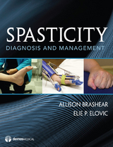 Spasticity - 