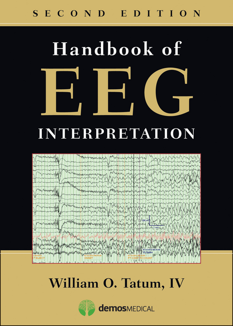 Handbook of EEG Interpretation - William Tatum