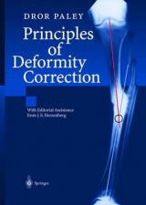 Principles of Deformity Correction - Dror Paley