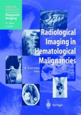 Radiological Imaging in Hematological Malignancies - 