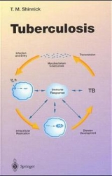 Tuberculosis - 