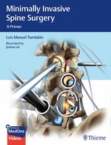 Minimally Invasive Spine Surgery -  Luis Manuel Tumialan