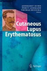 Cutaneous Lupus Erythematosus - 