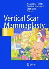 Vertical Scar Mammaplasty - 