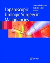 Laparoscopic Urologic Surgery in Malignancies - 