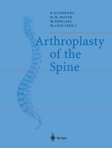 Arthroplasty of the Spine - 