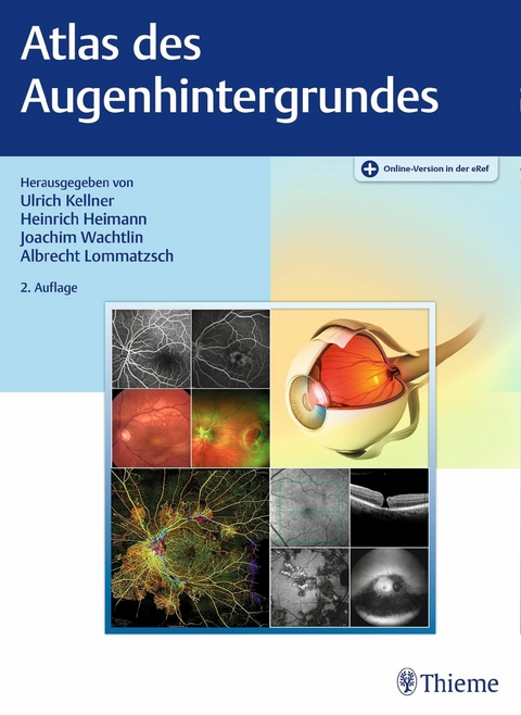 Atlas des Augenhintergrundes - 