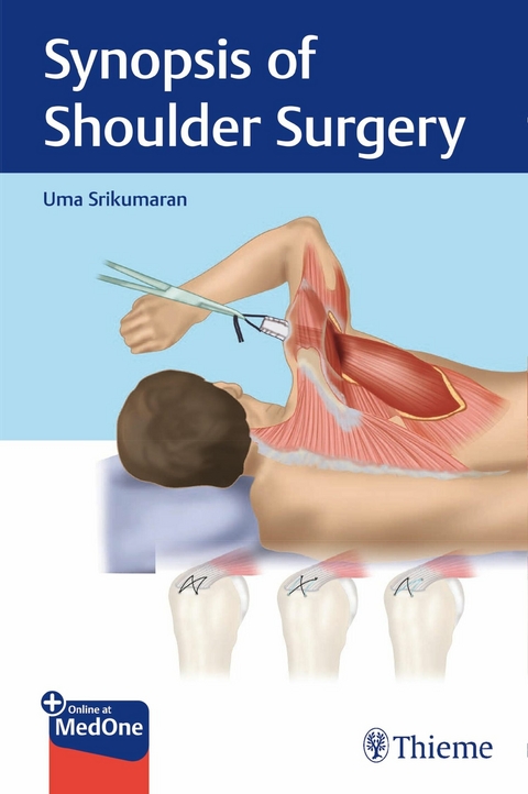 Synopsis of Shoulder Surgery -  Uma Srikumaran