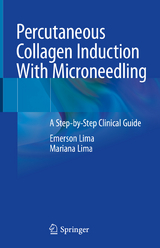 Percutaneous Collagen Induction With Microneedling - Emerson Lima, Mariana Lima