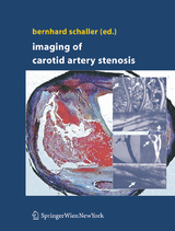 Imaging of Carotid Artery Stenosis - 