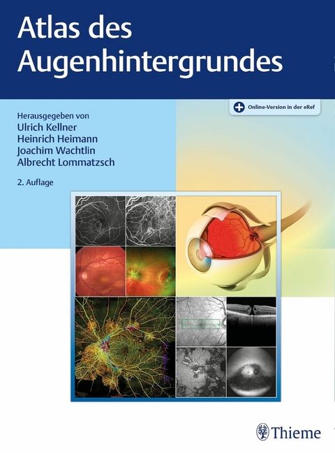 Atlas des Augenhintergrundes - 