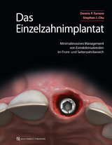 Das Einzelzahnimplantat - Dennis P. Tarnow, Stephen J. Chu