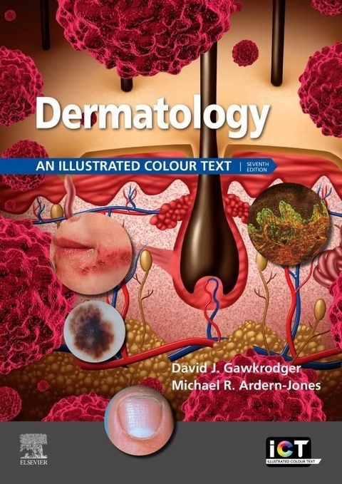 Dermatology E-Book -  Michael R. Ardern-Jones,  David Gawkrodger