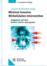 Minimal-Invasive Wirbelsäulen-Intervention - 