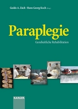 Paraplegie - 