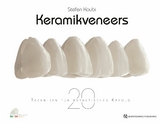 Keramikveneers - Stefen Koubi