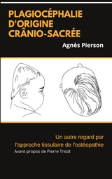 plagiocéphalie d'origine crânio-sacrée - Agnès Pierson