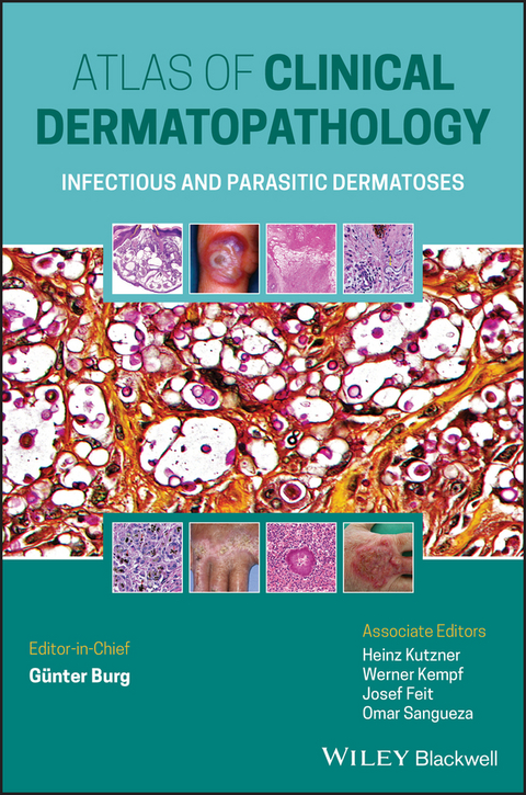 Atlas of Clinical Dermatopathology - 