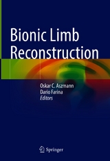 Bionic Limb Reconstruction - 