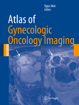 Atlas of Gynecologic Oncology Imaging - 