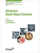 Anterior Skull Base Tumors - 