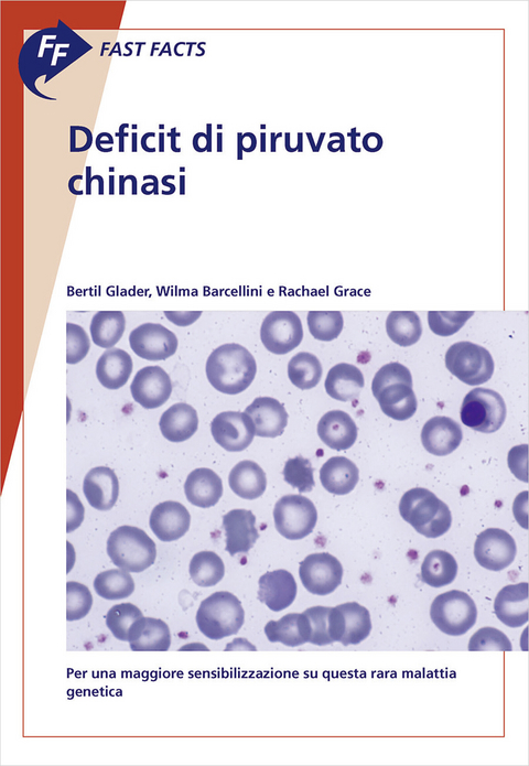 Fast Facts: Deficit di piruvato chinasi - B. Glader, W. Barcellini, R. Grace