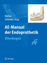 AE-Manual der Endoprothetik - 