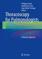 Thoracoscopy for Pulmonologists - 