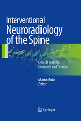 Interventional Neuroradiology of the Spine - 