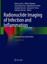 Radionuclide Imaging of Infection and Inflammation - 