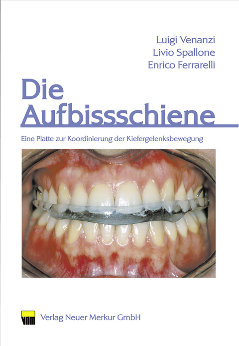 Die Aufbissschiene - Luigi Venanzi, Livio Spallone, Enrico Ferrarelli